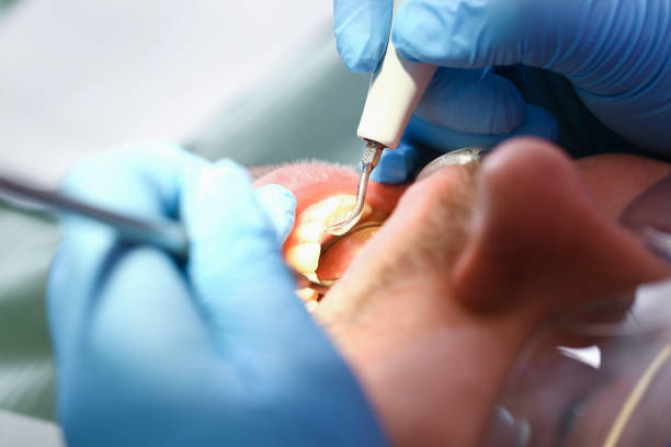 Best Emergency Dentist for Knocked-Out Tooth in Trenton, NJ