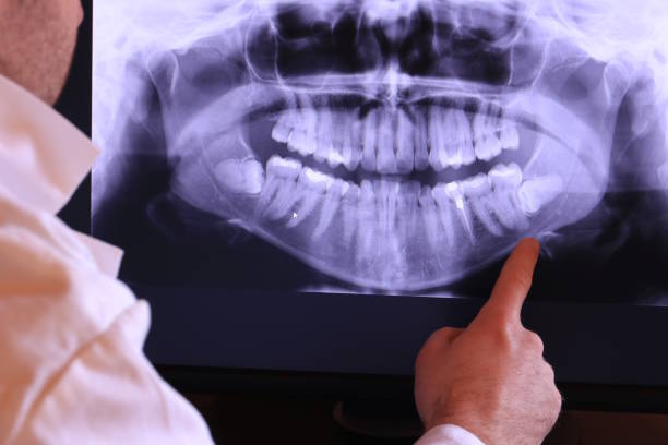 Best Urgent Dental Care for Toothache in Trenton, NJ