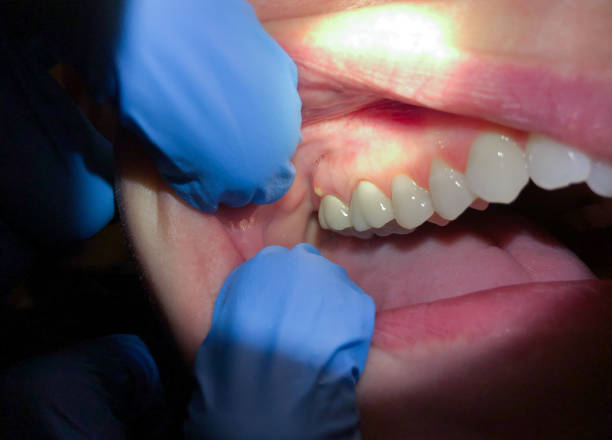 Best Emergency Cosmetic Dentistry in Trenton, NJ