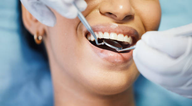 Best Emergency Dental Extractions in Trenton, NJ