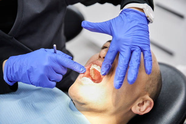 Best Emergency Dentist for Knocked-Out Tooth in Trenton, NJ